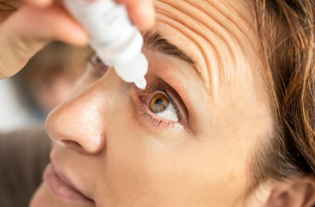 A person carefully applies prescription eye drops to treat their irritation.