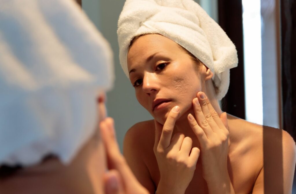 A woman with a towel wrapped around her head examines acne scars on her cheek while looking in the mirror.